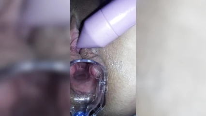 Ролевая игра у гинеколога